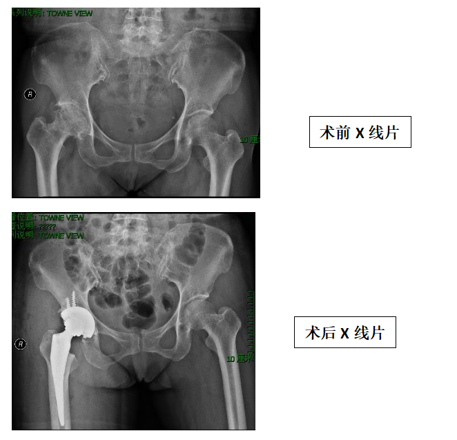 關節(jié)、運動醫(yī)學科特色技術